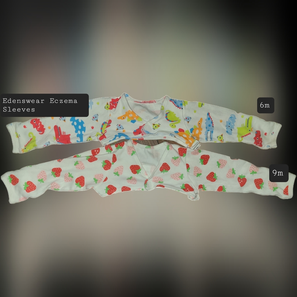 Edenswear Eczema Sleeves for babies